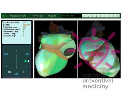 HeartVue_01_1.jpg